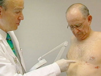 Diagnosing Shingles Treatment